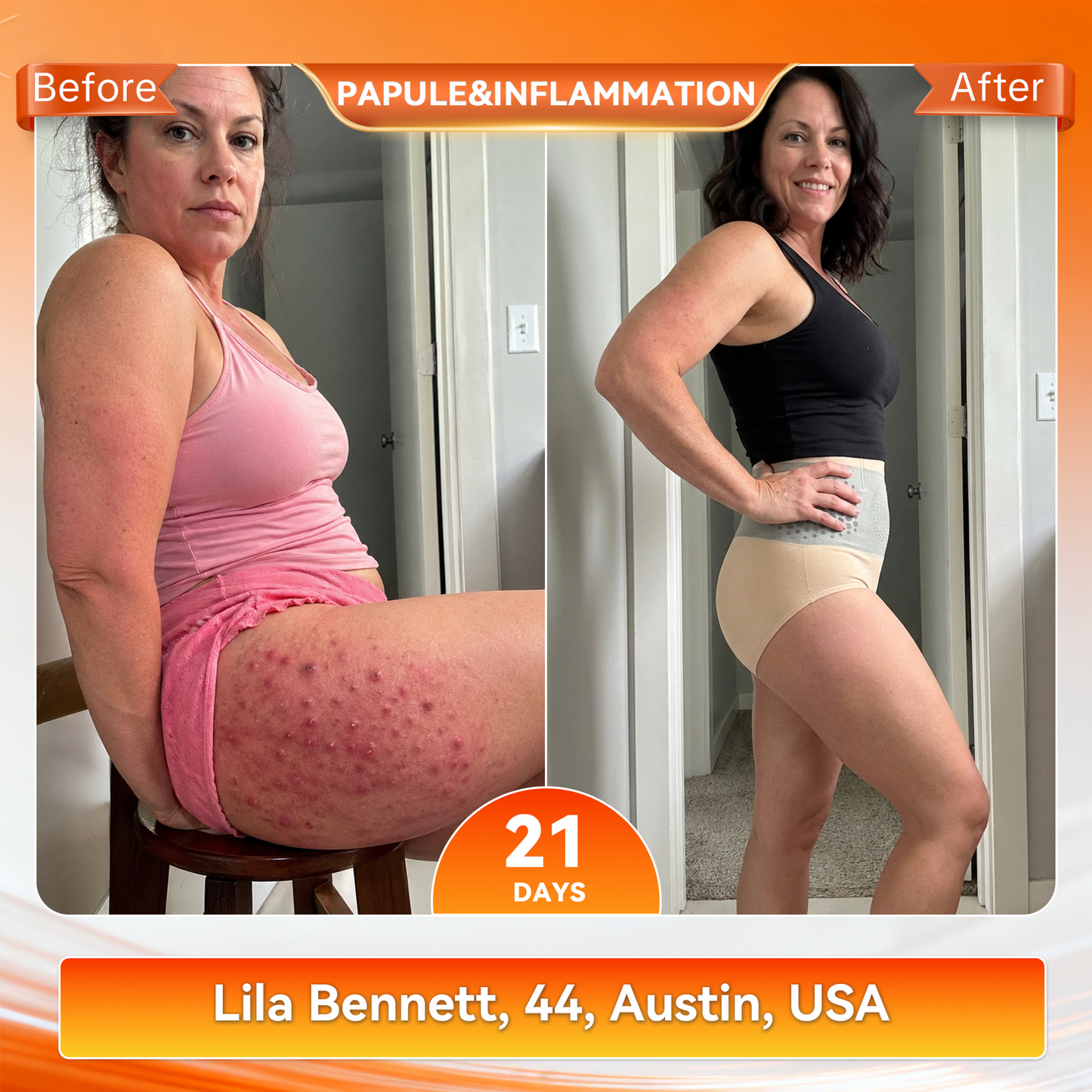Formiva® Moringa & Berberine 4-In-1 Micro-Particle Sculpting & Fat-Burn Shorts