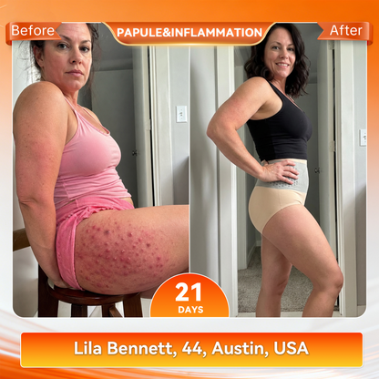 Formiva® Moringa & Berberine 4-In-1 Micro-Particle Sculpting & Fat-Burn Shorts